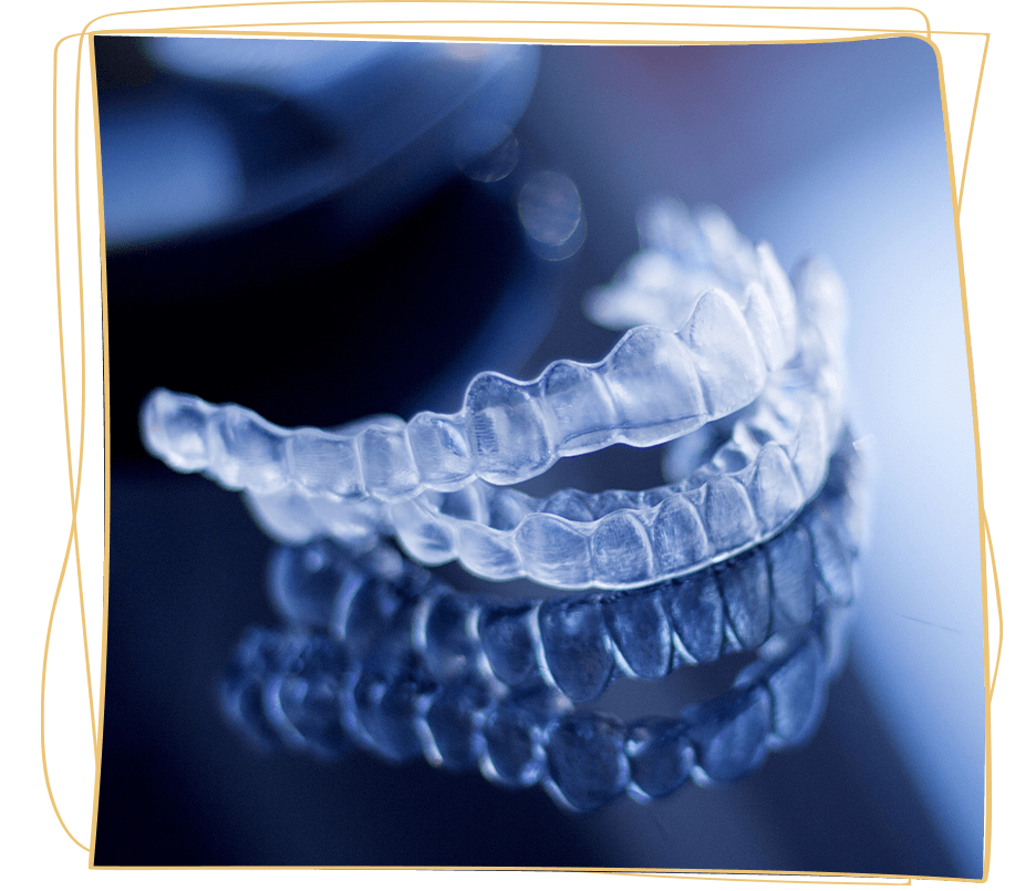 clear braces aligners