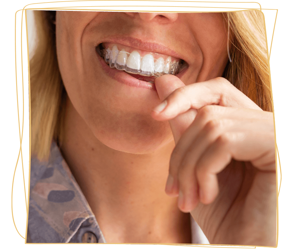 invisalign patient with aligner