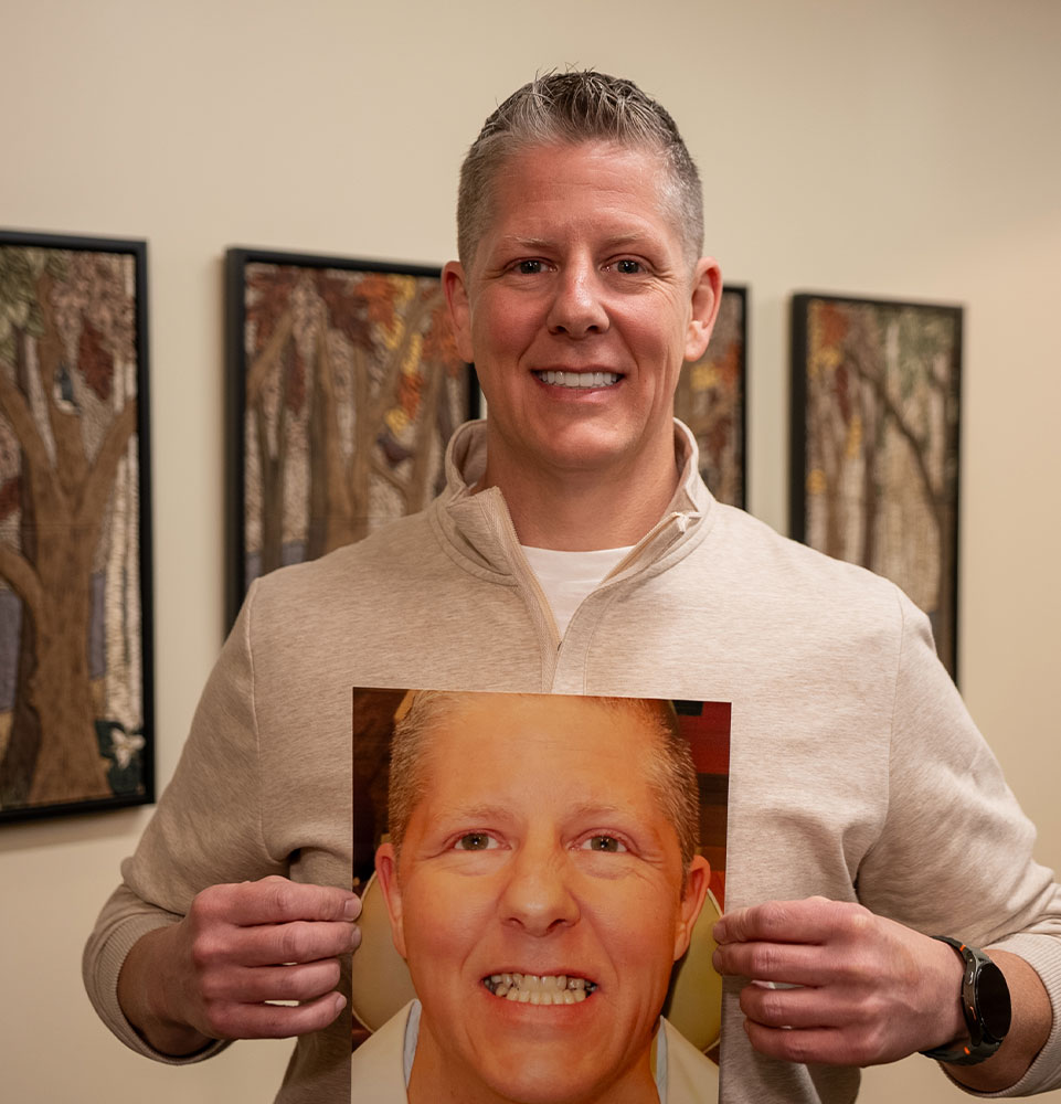 man with biege jacket with ba after his dental implants