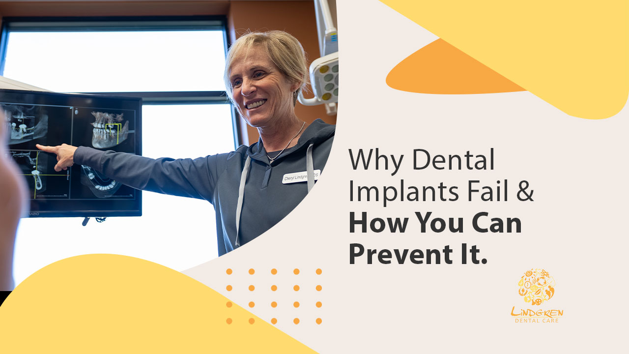 mv 1 why they can fail