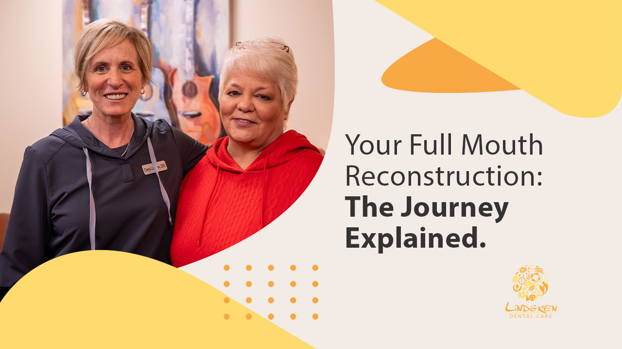 mv3 full mouth recon