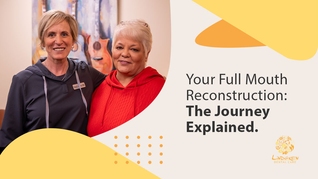 mv3 full mouth recon