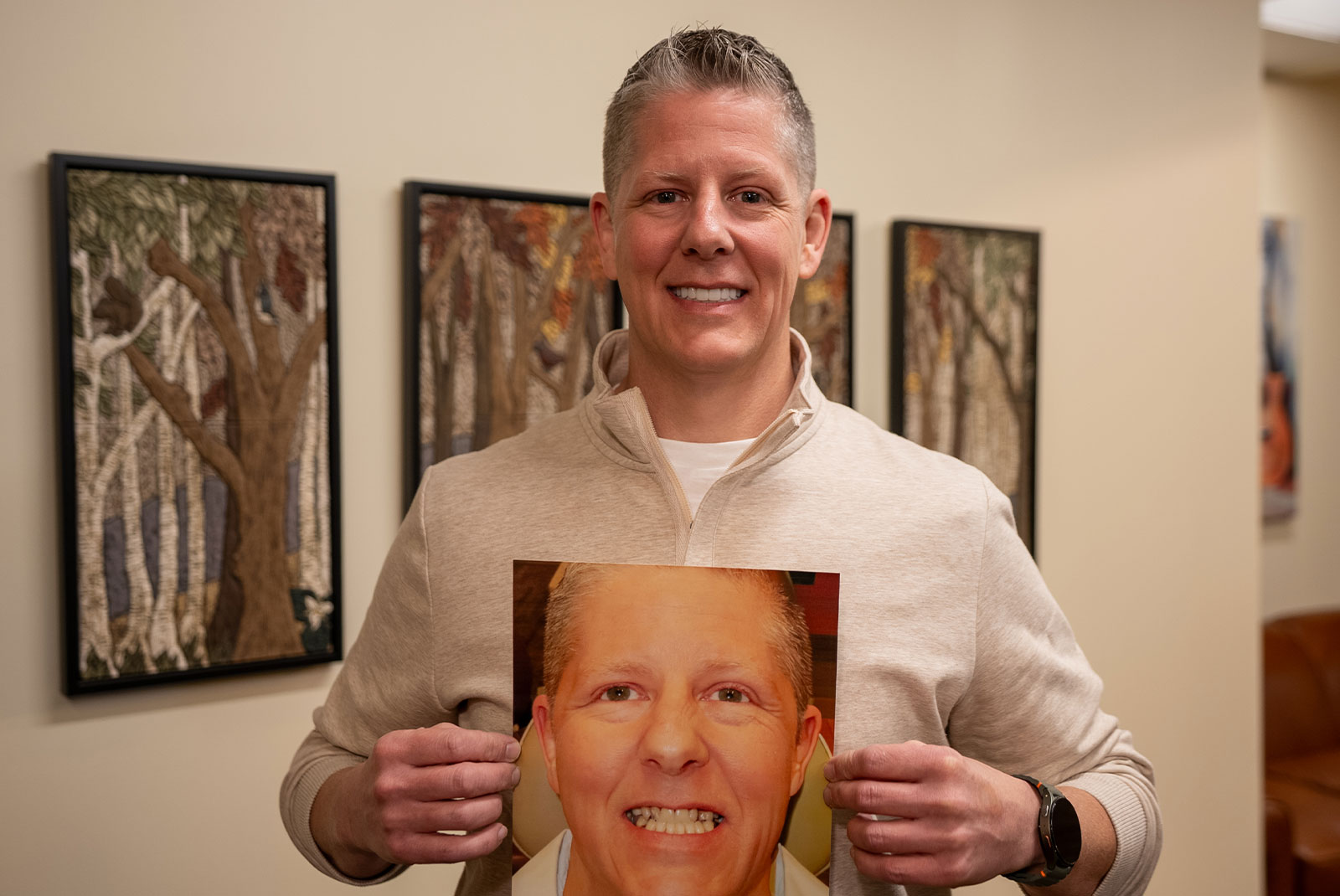 after dental implants before after