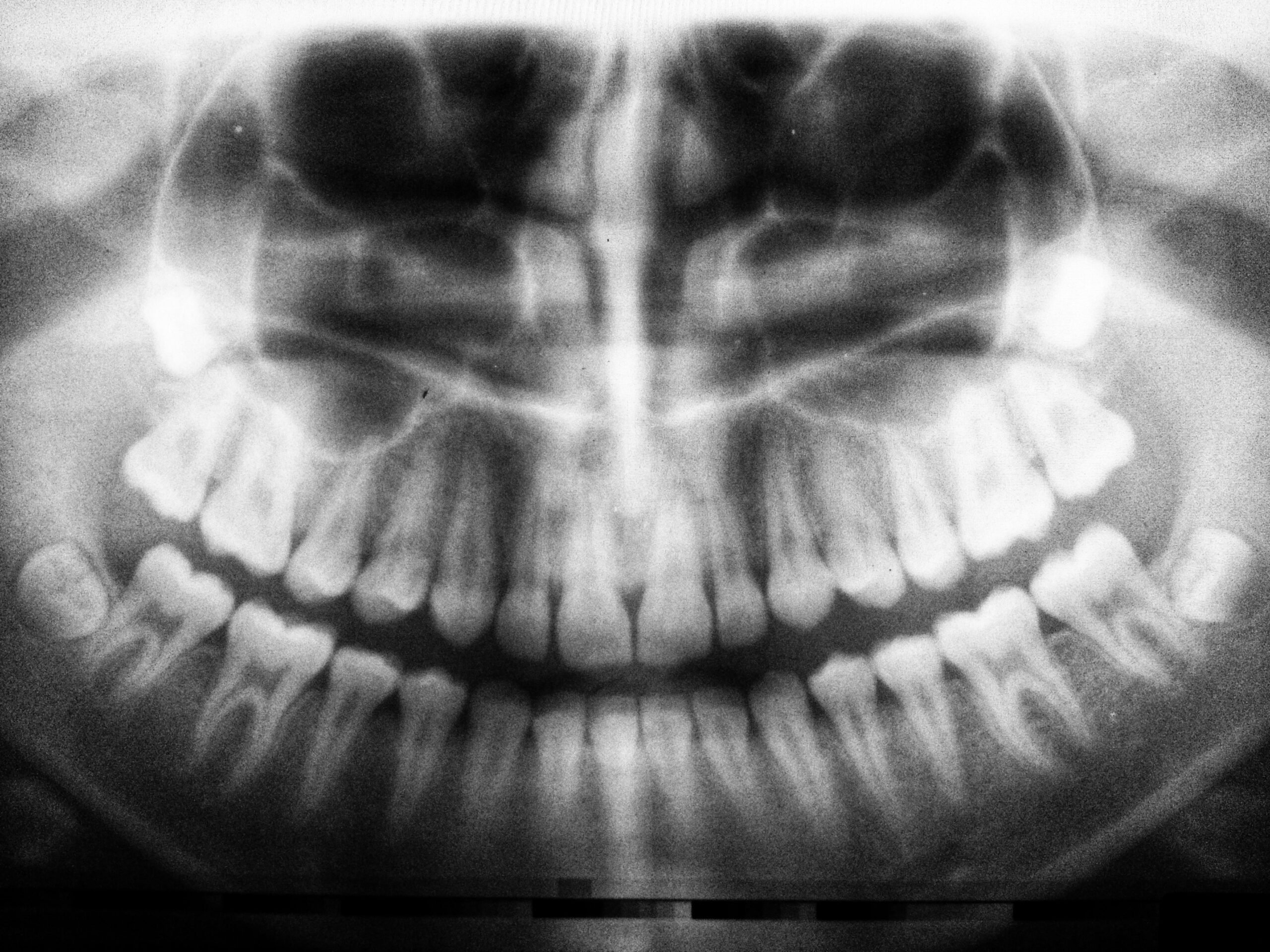 dental scans blog